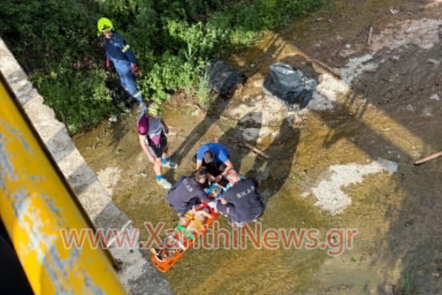 xanthi ptosi 17xroni 17 5